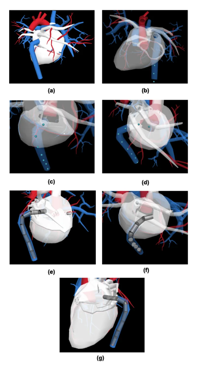 Haptic Virtual Fixtures for Preoperative Surgical Planning — figure 2