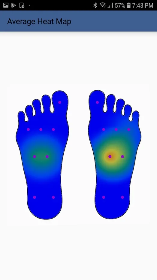 i-Shoe: Smart Insole for Gait Monitoring — figure 3